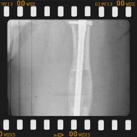 Radyografi görseli büyütmek için üzerine tıklayınız.