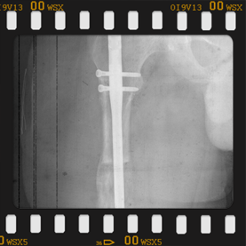 Radyografi görseli büyütmek için üzerine tıklayınız.