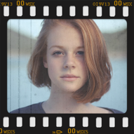 Prof. Dr. Halil Burç, Boy uzatma cerrahisi sonrası takip görüşmesinde hasta ile süreçleri takip eder.